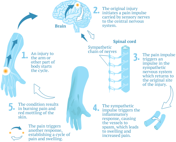 rsd-diagram